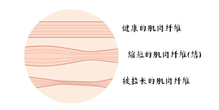 按摩|又get到一个毫不费力的瘦腿新招，为了Ta女明星竟然纷纷在节目里......