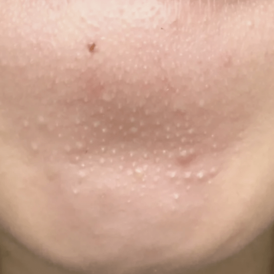 皮肤|纯分享：我最爱的11款小众面膜都在这了！