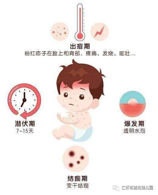 【疾病预防】幼儿园水痘预防保健知识