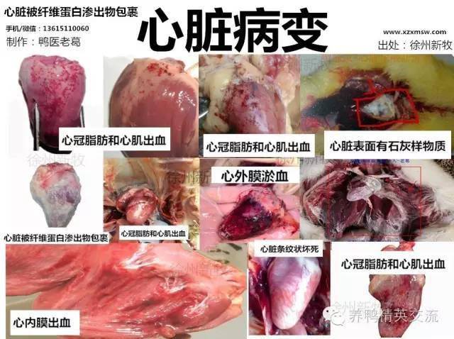 蛋白渗出物包裹鸭流感:心冠脂肪出血或者条纹状坏死(虎斑心)鸭霍乱