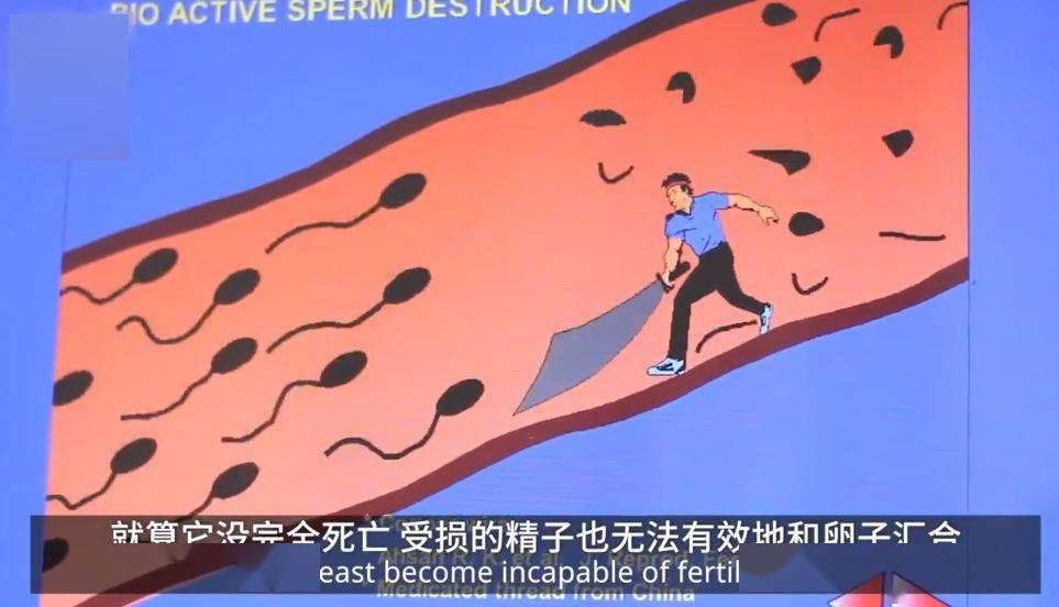 男性|再见了，避孕套！男性避孕针终于来了...佛山女生：爱我就打针！