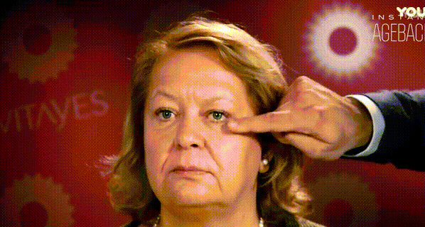 效果|震撼黑科技！搞定眼袋、细纹、浮肿、黑眼圈……效果比PS还好！