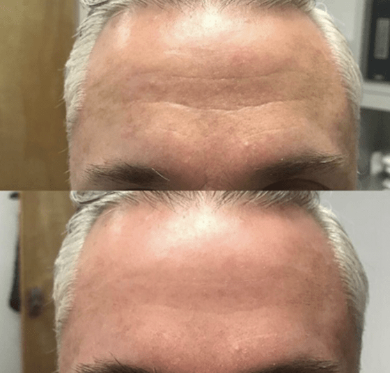 效果|震撼黑科技！搞定眼袋、细纹、浮肿、黑眼圈……效果比PS还好！