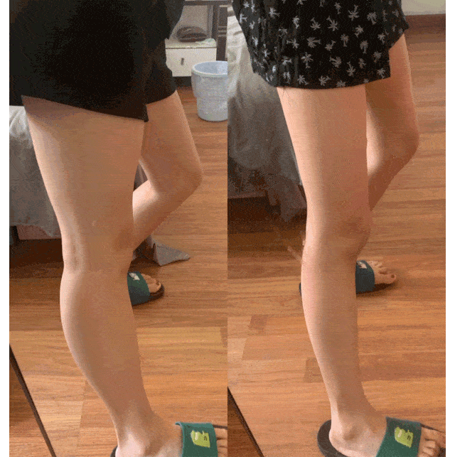 运动|吴昕被曝领证结婚啦？经历“换头”变美后人生果然能开挂！