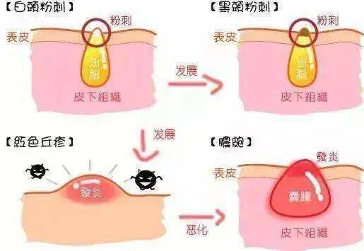 同事|三十而已,凭啥被00后同事比下去了?