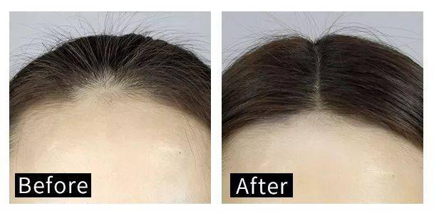 圣雪兰|快扔掉你的睫毛膏 ！这支睫毛增长液亲测有效 ！