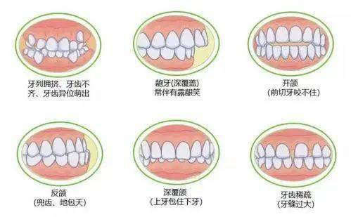 孩子矫正的这三个时期一定不要错过!_牙齿