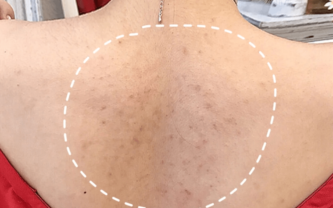 角质|薇娅吹爆的这款磨砂膏,我替你们试了,用完蚊子能在背上劈叉!