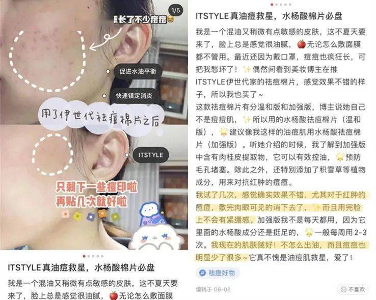 祛痘|30秒get医美“刷酸” ，从此和痘痘大毛孔形同陌路！