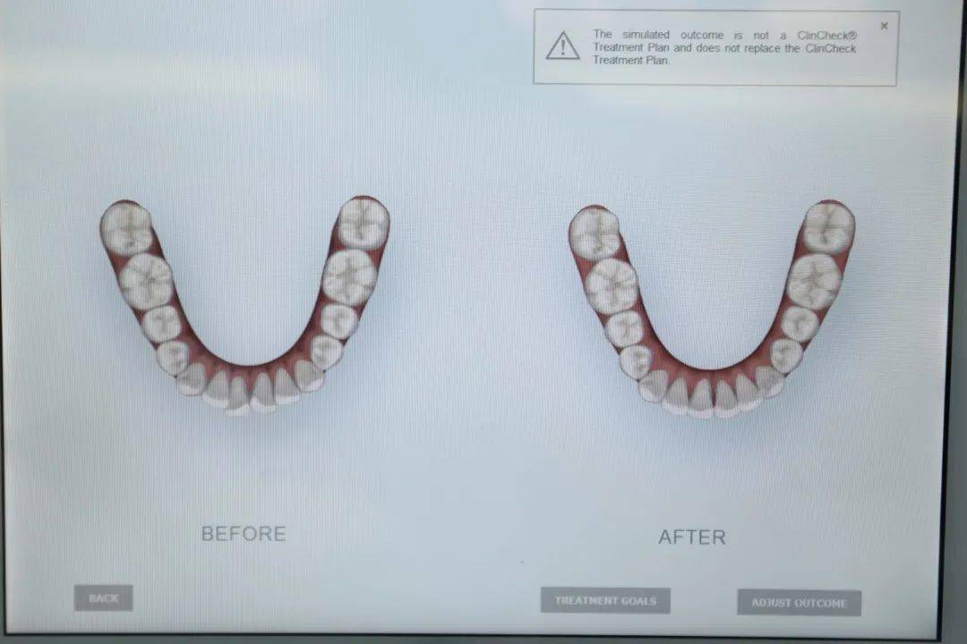 口腔|整牙比整容还要厉害？不动刀，不打针，悄悄变美的秘密就在这里！
