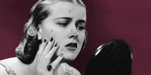 肌肤|脸上挤出的“白浆”是什么？原来是它作怪！出油、过敏也因此而起！