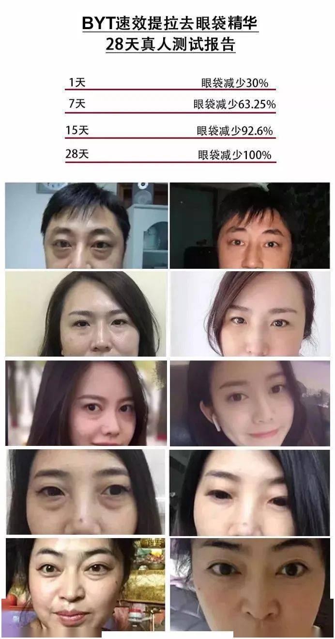 方法|眼袋显老又显丑，教你一方法轻松干掉它！！