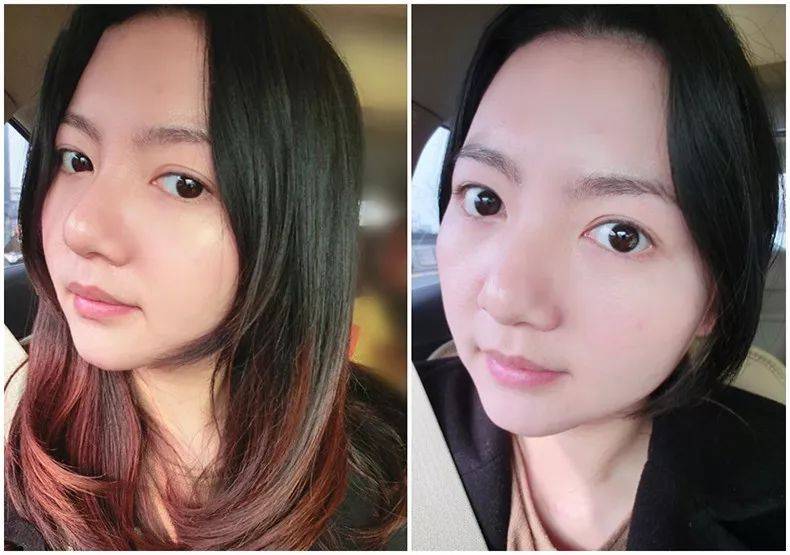 肌肤|脸上挤出的“白浆”是什么？原来是它作怪！出油、过敏也因此而起！