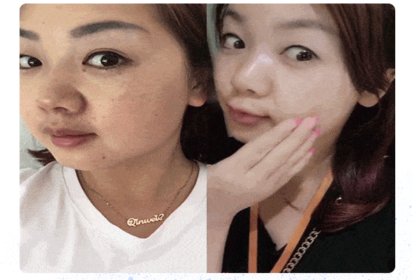 皱纹|抗皱抗衰老还在打针?用它赶走三八脸、鱼尾纹,让小朋友见到你都喊姐姐!