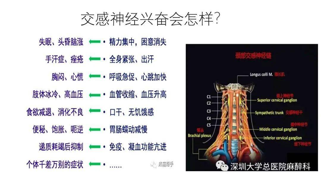 精品课件丨星状神经节阻滞