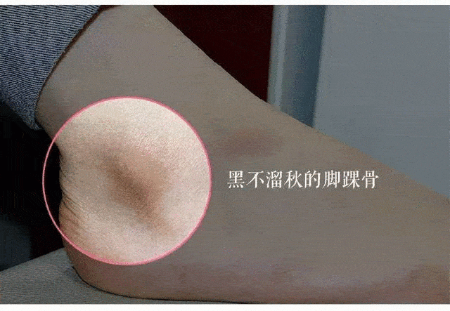 不知道|用1颗糖洗澡是什么体验？不洗都不知道身上这么脏，竟然还能扣出油脂粒！