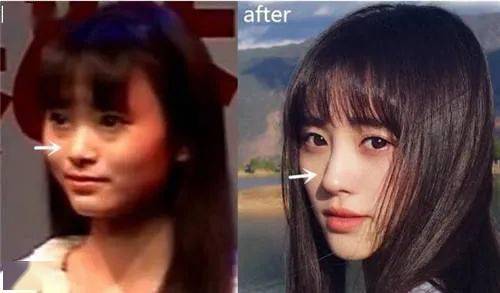 桃仔|整容黑历史都自曝了,景甜真是个狠人啊!