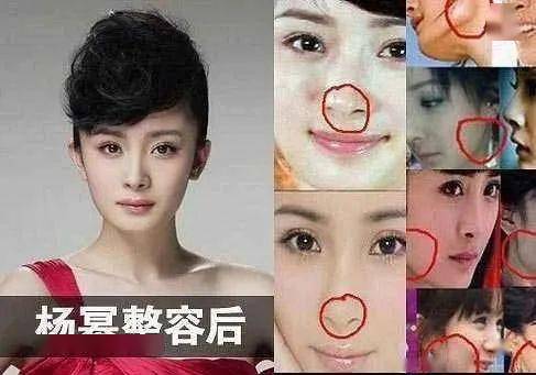 桃仔|整容黑历史都自曝了,景甜真是个狠人啊!