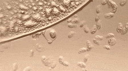 口腔|重度口臭者不刷牙，却依然口气清新？他只做了一件事...