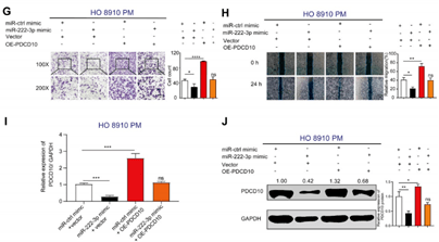 一篇theranostics教你如何设计emt 上皮间质转化 相关的国自然思路