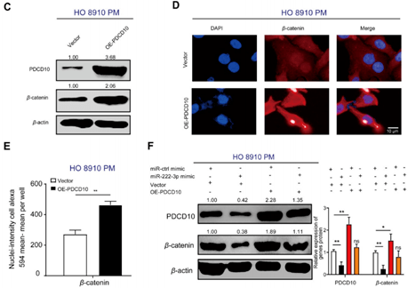 一篇theranostics教你如何设计emt 上皮间质转化 相关的国自然思路