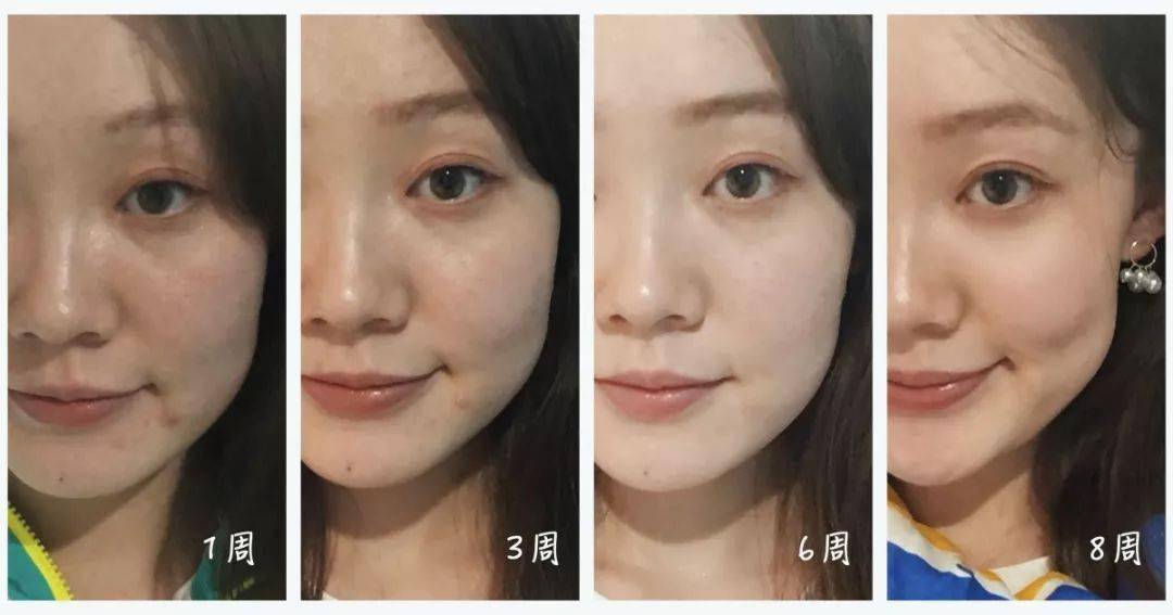 精华|快抢！每个女人都无法拒绝的雅诗兰黛小棕瓶，只要85元！