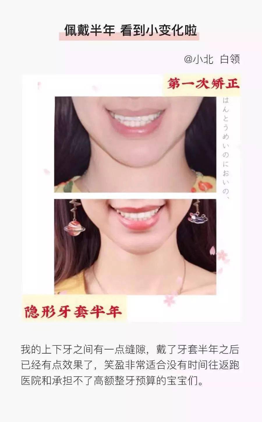 牙齿|“不会吧，不会吧，现在还有没整过牙的明星吧？”