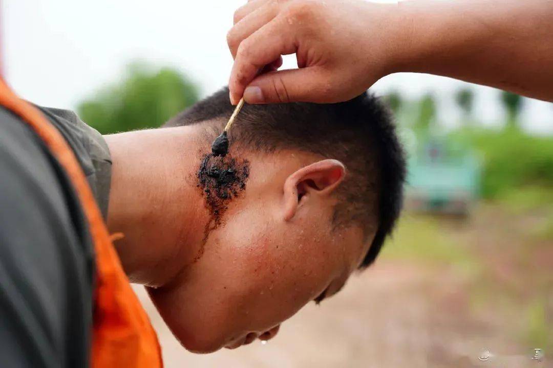 是因你们一次次逆行" 冲锋一线 抗洪战士的手脚磨出了血泡 皮肤晒伤出