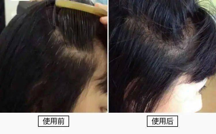 头发|大写的服！热巴居然连一根细小的发丝都不放过...