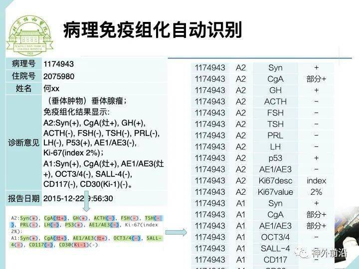 智慧神外 协和医院冯铭:大数据和人工智能在神经外科中的应用(访谈及