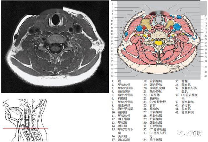 颈部详细的断层解剖
