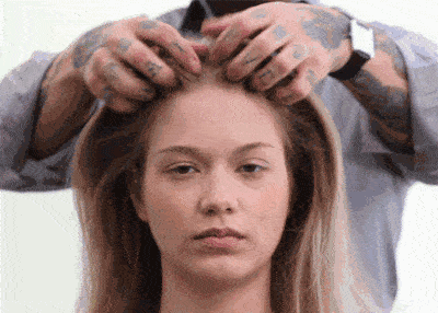 赢家|颅顶底爱出油...机智的发量赢家从来不怕