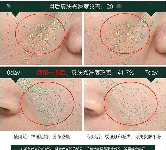 肌肤|40岁的年龄，18岁的脸，深扒“金喜善们”的冻龄术，竟然都是它！