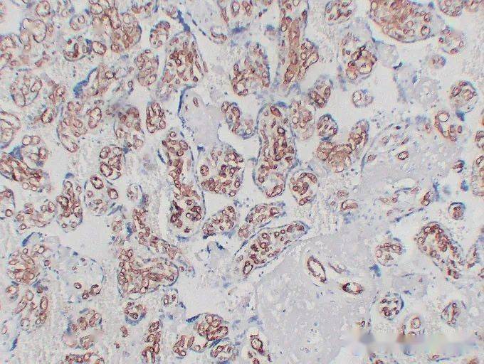免疫组化(ihc)│常见问题及解析集锦