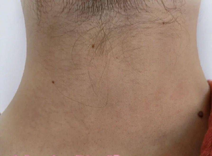 皮肤|白到发光的张雨绮性感冲出屏幕!这次成了“直女斩”