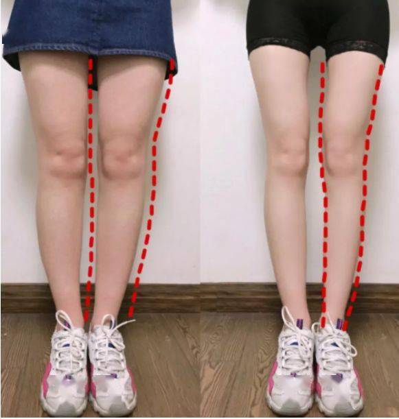 运动|“80斤的脸，120斤的腿”？魔力薇薇瘦腿裤来啦！全新升级千万不要错过！