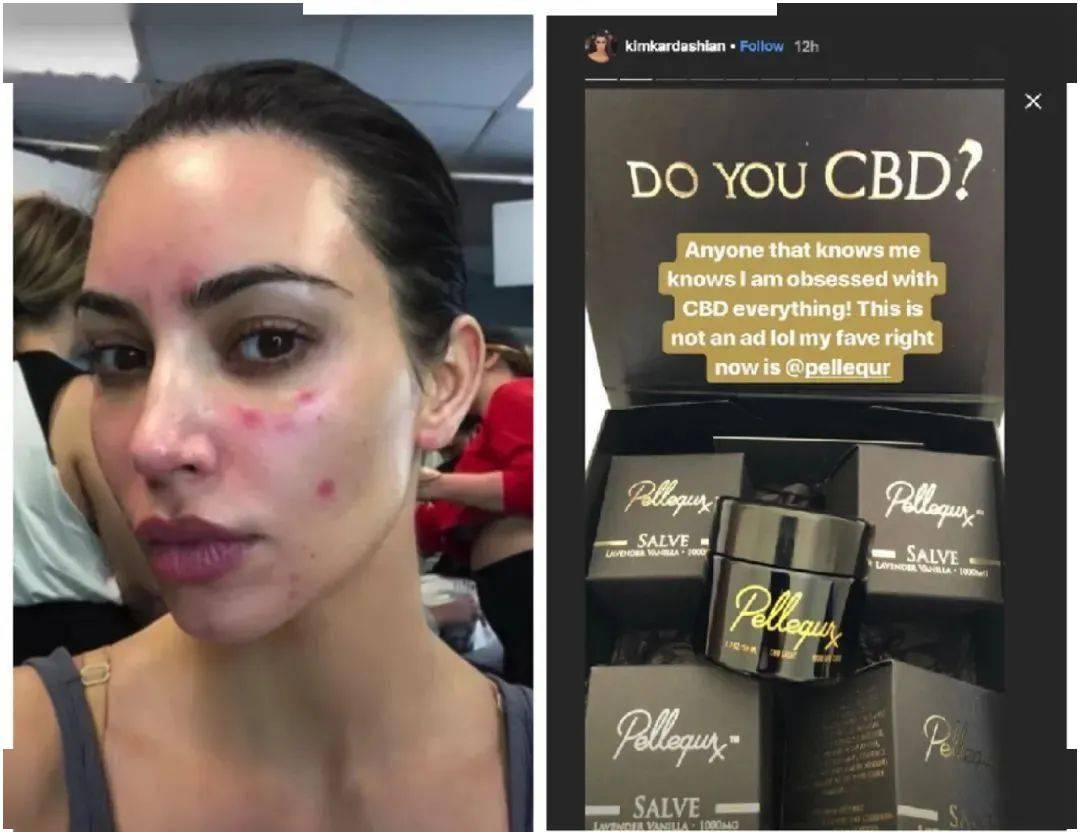 保养|张雨绮每月保养脸疑花70万，听了伊能静的金额……贫穷限制了我的想象