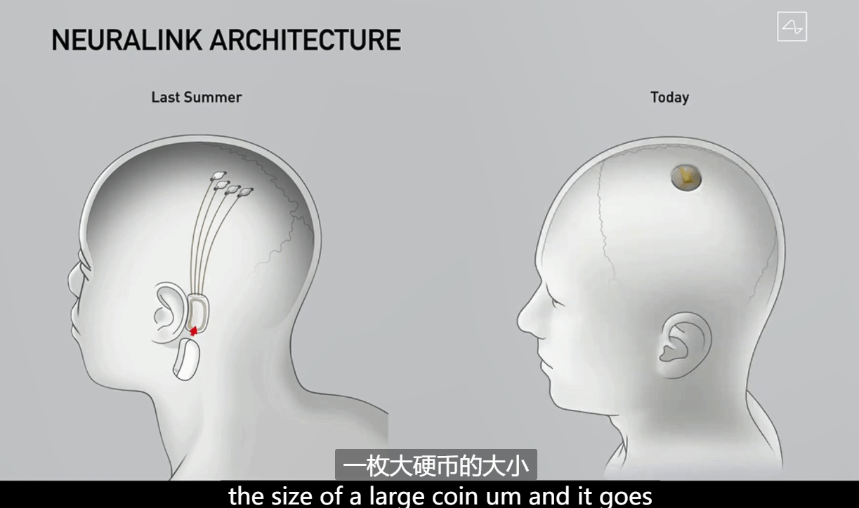 马斯克|电动车、可重复火箭之后，马斯克的脑机接口公司如何改变人类？