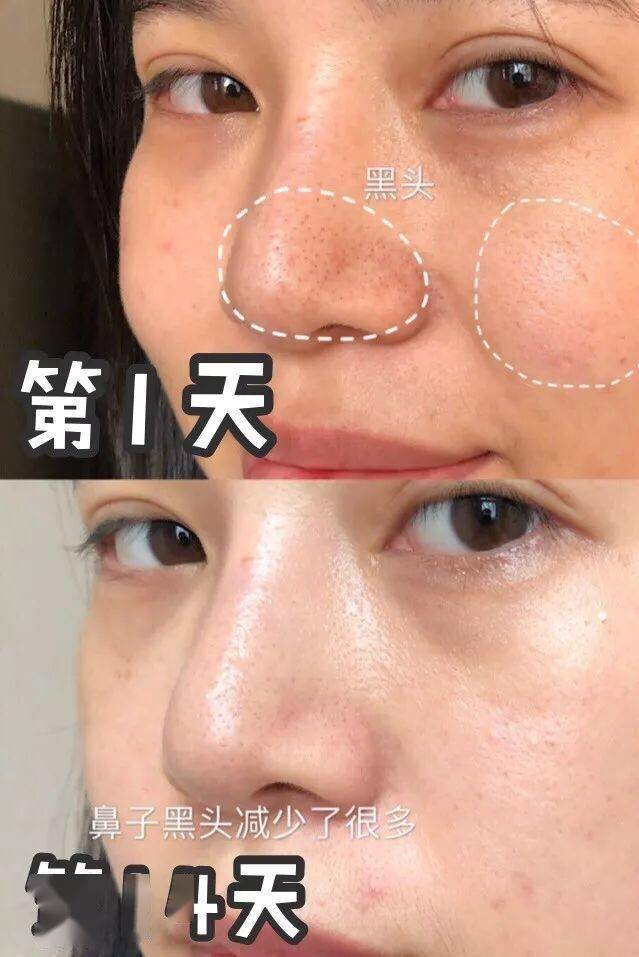 原液|对不起!HFP这么大的优惠我说晚了!!