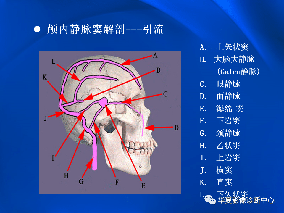 学习不倦颅内静脉窦血栓形成的影像学表现