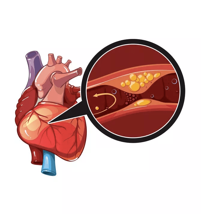 指标|宣医科普|一分钟看懂『三高』检查报告