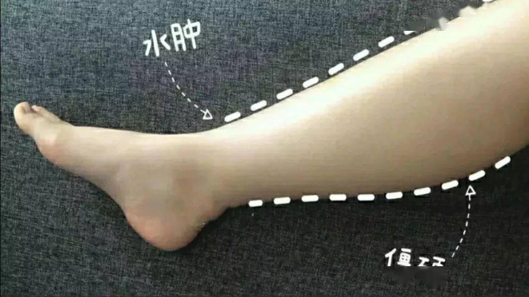 腿部|吴昕录制《乘风破浪的姐姐》都在用它,难怪万年小粗腿翻身成腿精!小腿细得像打了瘦腿针!