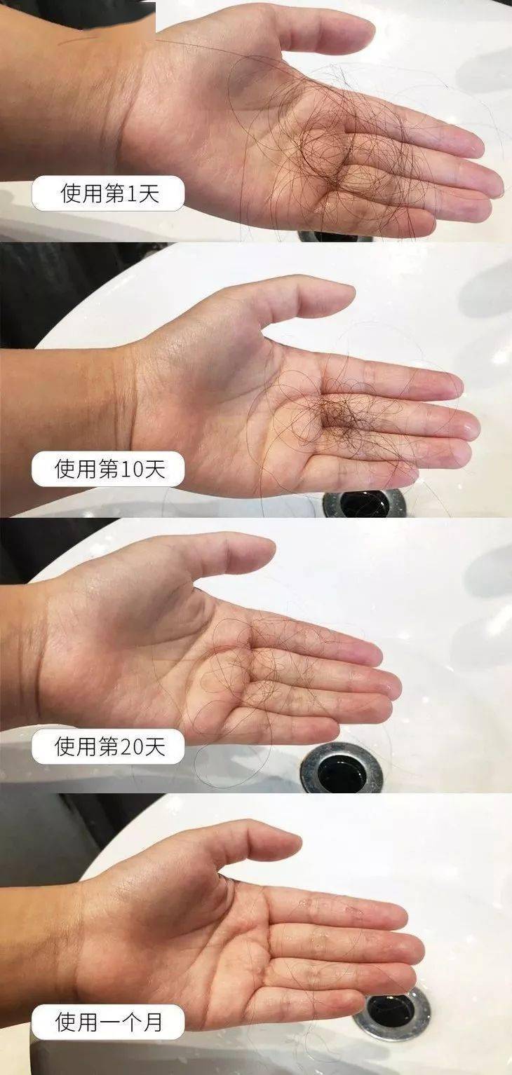 滋养液|32年才做成的育发液!让你挑战30天+生出小绒毛