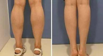 意大利|吴昕：你不瘦下来，永远不知道自己有多美！