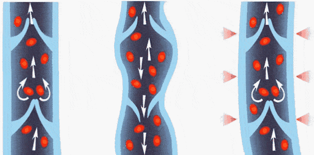 意大利|吴昕：你不瘦下来，永远不知道自己有多美！