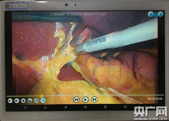 临床|“裸眼3D”技术助力医疗教学与临床培训 一台手术千人观摩将成现实