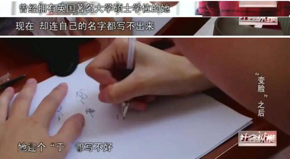 畸形|“我花100万，把女儿整成了残废”：畸形审美毒害下，有20万女孩正在消失！