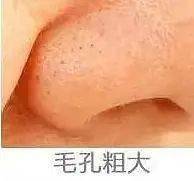 贫民窟|杨幂熬夜后护肤要花2万块？怪不得皮肤吹弹可破！贫民窟女孩就不配消除熬夜痘、黑眼圈吗？