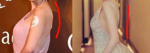 矫姿|被扒出来了！张雨绮“浪姐”全程穿它塑形！1s挺拔，让你气质好到爆