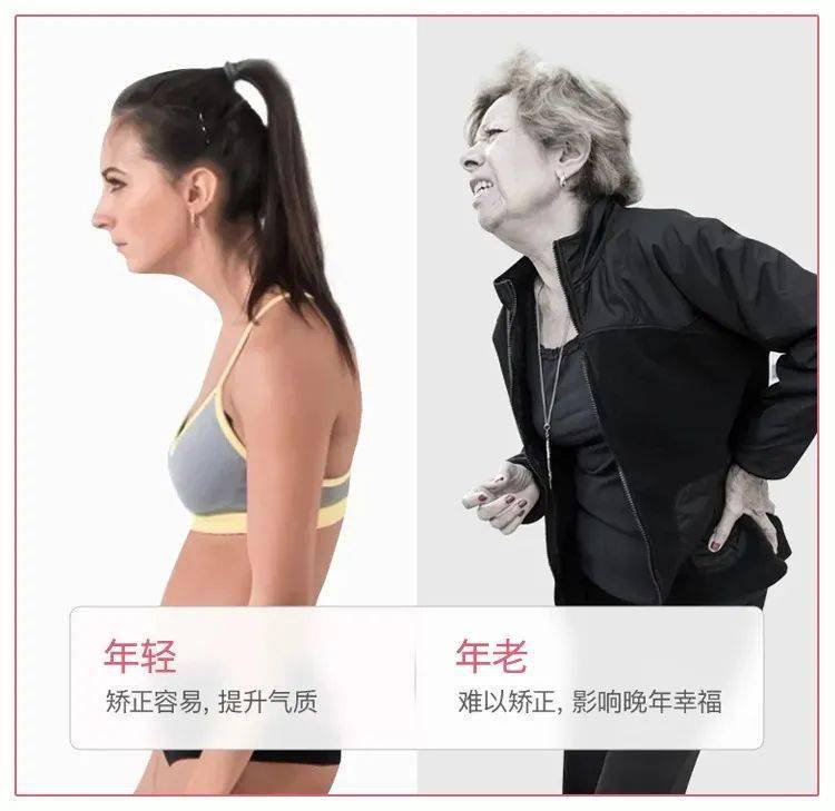 智商|张雨绮的矫姿带到底是智商税，还是真女神制造机？